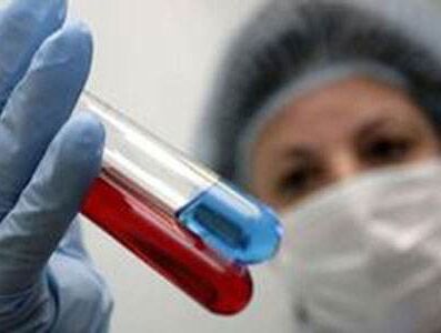 全自动蘑菇视频成人网站免费有哪些检测方法？