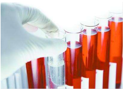 医用蘑菇视频下载入口厂家谈微量元素的检查流程 医用蘑菇视频下载入口厂家谈微量元素的检查流程